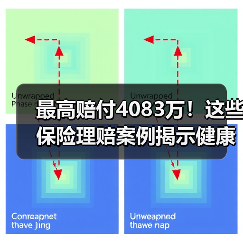 最高赔付4083万!这些保险理赔案例揭示健康风险防范关键(图1) 最高赔付4083万!这些保险理赔案例揭示健康风险防范关键(图1)